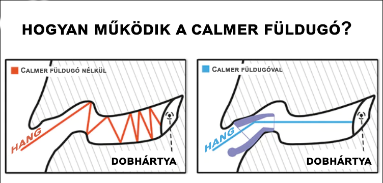 Hogyan működik a Calmer füldugó